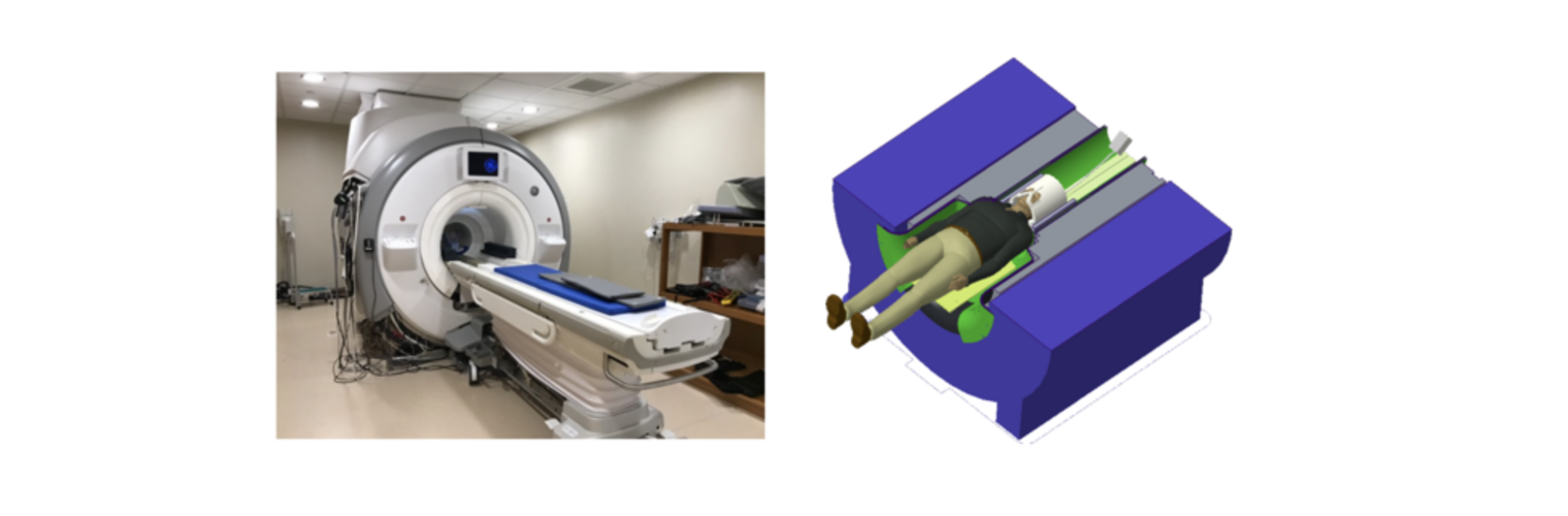 High Performance MRI System